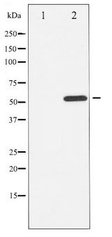 ATF2 Antibody - Western blot of ATF2 phosphorylation expression in LOVO whole cell lysates,The lane on the left is treated with the antigen-specific peptide.