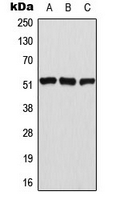 ATF2 Antibody - Western blot analysis of ATF2 (pT69) expression in HeLa (A); NIH3T3 (B); PC12 (C) whole cell lysates.