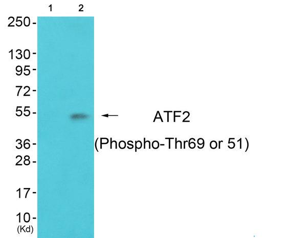ATF2 Antibody - Western blot analysis of extracts from LOVO cells. Line1: Using ATF-2 (Phospho-Thr69 or 51) Antibody; Line2: Using the same antibody preincubated with synthesized peptide.