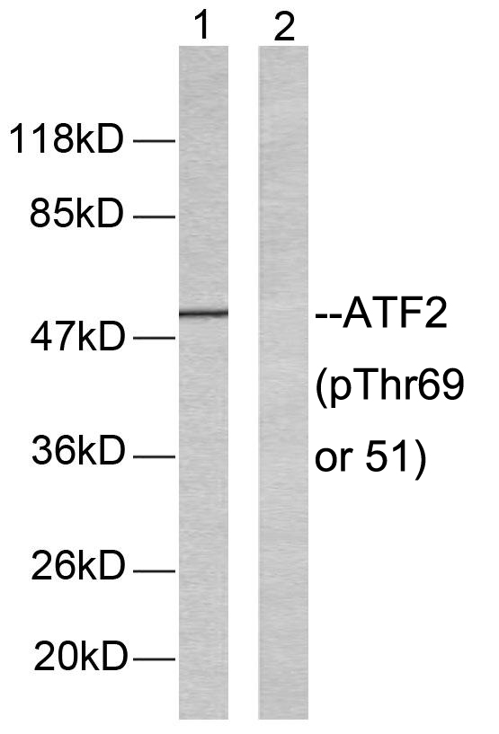 ATF2 Antibody - Western blot analysis of lysates from LOVO cells, using ATF2 (Phospho-Thr69 or 51) Antibody. The lane on the right is blocked with the phospho peptide.
