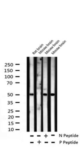 ATF2 Antibody - Western blot analysis of Phospho-ATF2 (Thr69 or 51) expression in various lysates