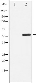 ATF2 Antibody - Western blot analysis of ATF2 phosphorylation expression in LOVO cells whole cells lysates. The lane on the left is treated with the antigen-specific peptide.