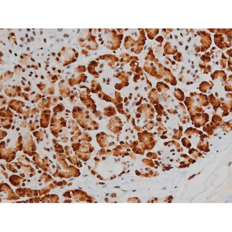 ATF2 Antibody - 1:200 staining human pancreas tissue by IHC-P. The tissue was formaldehyde fixed and a heat mediated antigen retrieval step in citrate buffer was performed. The tissue was then blocked and incubated with the antibody for 1.5 hours at 22°C. An HRP conjugated goat anti-rabbit antibody was used as the secondary.