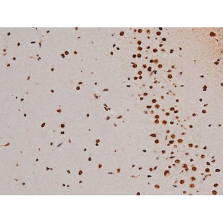 ATF2 Antibody - 1:200 staining mouse brain tissue by IHC-P. The tissue was formaldehyde fixed and a heat mediated antigen retrieval step in citrate buffer was performed. The tissue was then blocked and incubated with the antibody for 1.5 hours at 22°C. An HRP conjugated goat anti-rabbit antibody was used as the secondary.