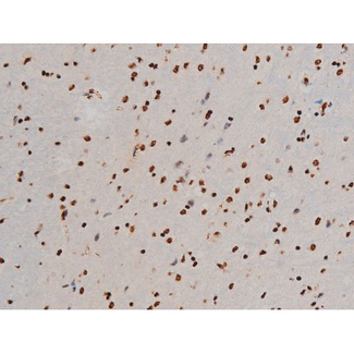 ATF2 Antibody - 1:200 staining mouse brain tissue by IHC-P. The tissue was formaldehyde fixed and a heat mediated antigen retrieval step in citrate buffer was performed. The tissue was then blocked and incubated with the antibody for 1.5 hours at 22°C. An HRP conjugated goat anti-rabbit antibody was used as the secondary.