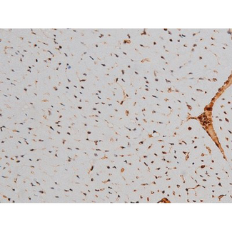 ATF2 Antibody - 1:200 staining mouse heart tissue by IHC-P. The tissue was formaldehyde fixed and a heat mediated antigen retrieval step in citrate buffer was performed. The tissue was then blocked and incubated with the antibody for 1.5 hours at 22°C. An HRP conjugated goat anti-rabbit antibody was used as the secondary.