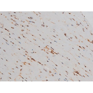 ATF2 Antibody - 1:200 staining mouse heart tissue by IHC-P. The tissue was formaldehyde fixed and a heat mediated antigen retrieval step in citrate buffer was performed. The tissue was then blocked and incubated with the antibody for 1.5 hours at 22°C. An HRP conjugated goat anti-rabbit antibody was used as the secondary.