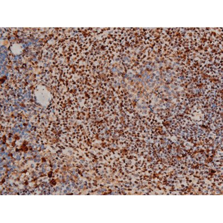 ATF2 Antibody - 1:200 staining mouse spleen tissue by IHC-P. The tissue was formaldehyde fixed and a heat mediated antigen retrieval step in citrate buffer was performed. The tissue was then blocked and incubated with the antibody for 1.5 hours at 22°C. An HRP conjugated goat anti-rabbit antibody was used as the secondary.
