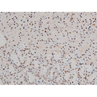 ATF2 Antibody - 1:200 staining rat ganstric tissue by IHC-P. The tissue was formaldehyde fixed and a heat mediated antigen retrieval step in citrate buffer was performed. The tissue was then blocked and incubated with the antibody for 1.5 hours at 22°C. An HRP conjugated goat anti-rabbit antibody was used as the secondary.