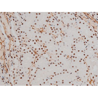 ATF2 Antibody - 1:200 staining rat kidney tissue by IHC-P. The tissue was formaldehyde fixed and a heat mediated antigen retrieval step in citrate buffer was performed. The tissue was then blocked and incubated with the antibody for 1.5 hours at 22°C. An HRP conjugated goat anti-rabbit antibody was used as the secondary.