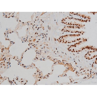 ATF2 Antibody - 1:200 staining rat lung tissue by IHC-P. The tissue was formaldehyde fixed and a heat mediated antigen retrieval step in citrate buffer was performed. The tissue was then blocked and incubated with the antibody for 1.5 hours at 22°C. An HRP conjugated goat anti-rabbit antibody was used as the secondary.