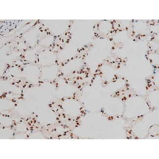 ATF2 Antibody - 1:200 staining rat lung tissue by IHC-P. The tissue was formaldehyde fixed and a heat mediated antigen retrieval step in citrate buffer was performed. The tissue was then blocked and incubated with the antibody for 1.5 hours at 22°C. An HRP conjugated goat anti-rabbit antibody was used as the secondary.