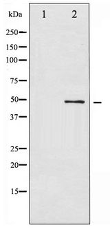 ATF2 Antibody - Western blot of ATF2 phosphorylation expression in HeLa whole cell lysates,The lane on the left is treated with the antigen-specific peptide.
