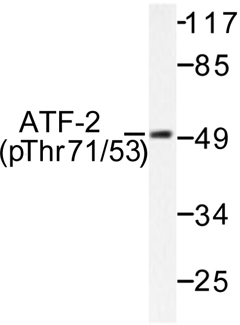 ATF2 Antibody - Western blot of p-ATF2 (T71/53) pAb in extracts from HeLa cells treated with UV.