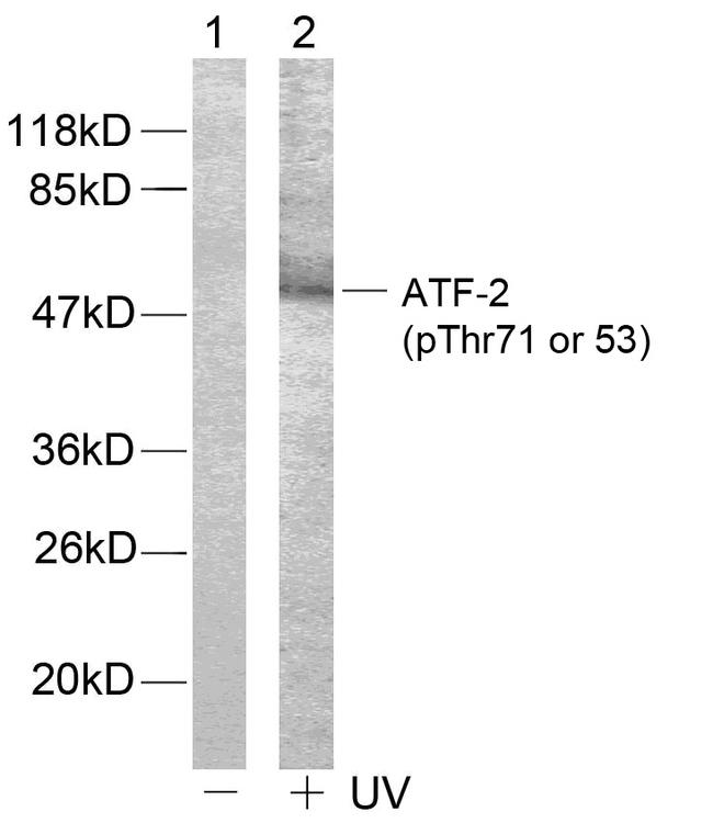 ATF2 Antibody - Western blot analysis of extracts, using ATF-2 (Phospho-Thr71 or 53) Antibody. Line1: The extracts from HeLa cells untreated; Line2: The extracts from HeLa cells treated with UV.