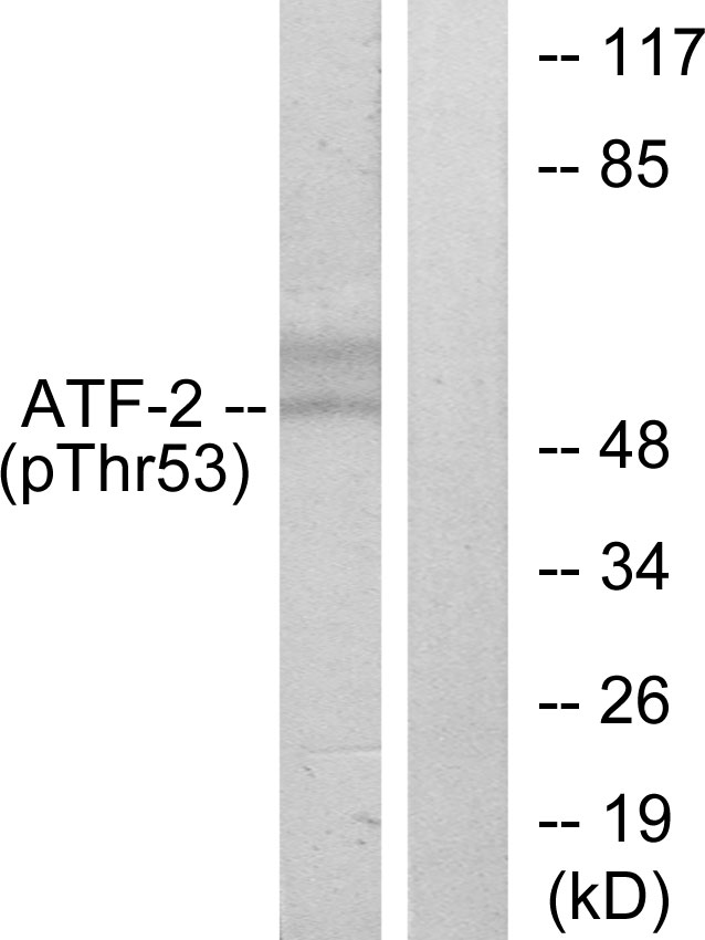 ATF2 Antibody - Western blot analysis of lysates from HeLa cells treated with UV, using ATF2 (Phospho-Thr71 or 53) Antibody. The lane on the right is blocked with the phospho peptide.