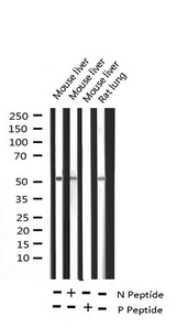ATF2 Antibody - Western blot analysis of Phospho-ATF2 (Thr71 or 53) expression in various lysates