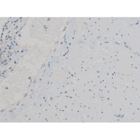ATF2 Antibody - 1:200 staining human esophagus tissue by IHC-P. The tissue was formaldehyde fixed and a heat mediated antigen retrieval step in citrate buffer was performed. The tissue was then blocked and incubated with the antibody for 1.5 hours at 22°C. An HRP conjugated goat anti-rabbit antibody was used as the secondary.