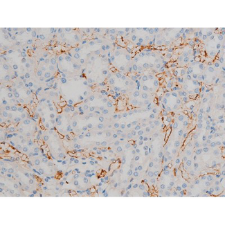ATF2 Antibody - 1:200 staining rat kidney tissue by IHC-P. The tissue was formaldehyde fixed and a heat mediated antigen retrieval step in citrate buffer was performed. The tissue was then blocked and incubated with the antibody for 1.5 hours at 22°C. An HRP conjugated goat anti-rabbit antibody was used as the secondary.
