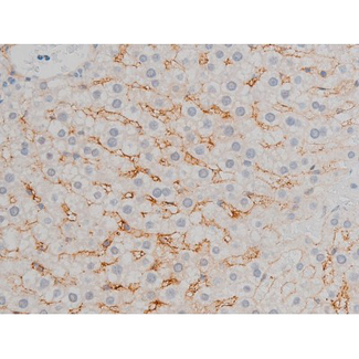 ATF2 Antibody - 1:200 staining rat liver tissue by IHC-P. The tissue was formaldehyde fixed and a heat mediated antigen retrieval step in citrate buffer was performed. The tissue was then blocked and incubated with the antibody for 1.5 hours at 22°C. An HRP conjugated goat anti-rabbit antibody was used as the secondary.
