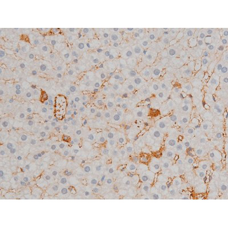 ATF2 Antibody - 1:200 staining rat liver tissue by IHC-P. The tissue was formaldehyde fixed and a heat mediated antigen retrieval step in citrate buffer was performed. The tissue was then blocked and incubated with the antibody for 1.5 hours at 22°C. An HRP conjugated goat anti-rabbit antibody was used as the secondary.