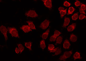 ATF2 Antibody - Staining HeLa cells by IF/ICC. The samples were fixed with PFA and permeabilized in 0.1% Triton X-100, then blocked in 10% serum for 45 min at 25°C. The primary antibody was diluted at 1:200 and incubated with the sample for 1 hour at 37°C. An Alexa Fluor 594 conjugated goat anti-rabbit IgG (H+L) Ab, diluted at 1/600, was used as the secondary antibody.
