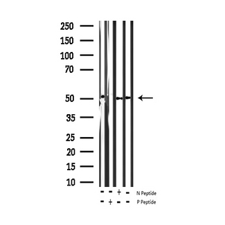 ATF2 Antibody - Western blot analysis of Phospho-ATF2 (Thr73 or 55) expression in various lysates