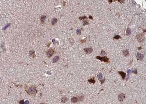 ATF2 Antibody - 1:100 staining human brain tissue by IHC-P. The tissue was formaldehyde fixed and a heat mediated antigen retrieval step in citrate buffer was performed. The tissue was then blocked and incubated with the antibody for 1.5 hours at 22°C. An HRP conjugated goat anti-rabbit antibody was used as the secondary.