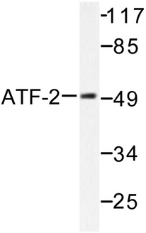 ATF2 Antibody - Western blot of ATF2 (V63/45) pAb in extracts from LOVO cells.