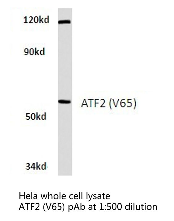 ATF2 Antibody - Western blot of ATF2 (V65/47) pAb in extracts from HeLa cells.