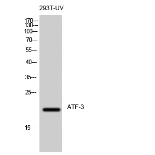 ATF3 Antibody - Western blot of ATF-3 antibody