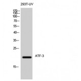 ATF3 Antibody - Western blot of ATF-3 antibody