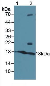 ATF3 Antibody - Western Blot; Sample: Lane1: Human Serum; Lane2: Human 293T Cells.