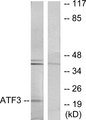 ATF3 Antibody - Western blot analysis of lysates from RAW264.7 cells, using ATF3 Antibody. The lane on the right is blocked with the synthesized peptide.