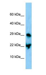 ATF3 Antibody - ATF3 antibody Western Blot of Mouse Stomach.  This image was taken for the unconjugated form of this product. Other forms have not been tested.