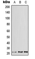 ATF3 Antibody - Western blot analysis of ATF3 expression in HeLa (A); mouse heart (B); rat heart (C) whole cell lysates.