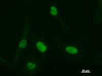 ATF3 Antibody - Immunostaining analysis in HeLa cells. HeLa cells were fixed with 4% paraformaldehyde and permeabilized with 0.1% Triton X-100 in PBS. The cells were immunostained with anti-ATF3 mAb.