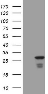 ATF3 Antibody - HEK293T cells were transfected with the pCMV6-ENTRY control. (Left lane) or pCMV6-ENTRY ATF3. (Right lane) cDNA for 48 hrs and lysed. Equivalent amounts of cell lysates. (5 ug per lane) were separated by SDS-PAGE and immunoblotted with anti-ATF3. (1:2000)