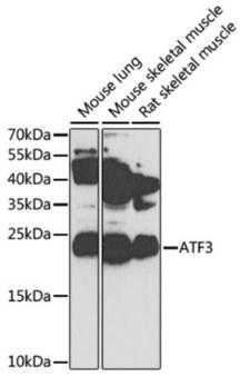 ATF3 Antibody - Western blot analysis of extracts of various cell lines, using ATF3 antibody  at 1:1000 dilution. Secondary antibody: HRP Goat Anti-Rabbit IgG (H+L)  at 1:10000 dilution. Lysates/proteins: 25ug per lane. Blocking buffer: 3% nonfat dry milk in TBST. Detection: ECL Basic Kit. Exposure time: 90s.