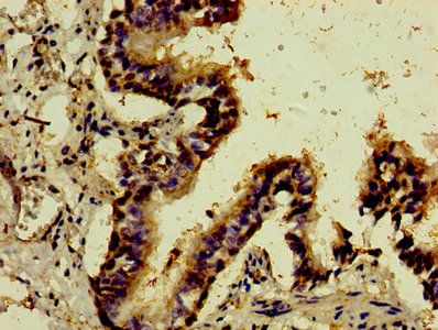 ATF3 Antibody - Immunohistochemistry of paraffin-embedded human lung tissue using ATF3 Antibody at dilution of 1:100