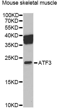 ATF3 Antibody - Western blot analysis of extracts of mouse skeletal muscle, using ATF3 Antibody at 1:1000 dilution. The secondary antibody used was an HRP Goat Anti-Rabbit IgG (H+L) at 1:10000 dilution. Lysates were loaded 25ug per lane and 3% nonfat dry milk in TBST was used for blocking. An ECL Kit was used for detection and the exposure time was 60s.