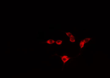 ATF3 Antibody - Staining RAW264.7 cells by IF/ICC. The samples were fixed with PFA and permeabilized in 0.1% Triton X-100, then blocked in 10% serum for 45 min at 25°C. The primary antibody was diluted at 1:200 and incubated with the sample for 1 hour at 37°C. An Alexa Fluor 594 conjugated goat anti-rabbit IgG (H+L) antibody, diluted at 1/600, was used as secondary antibody.