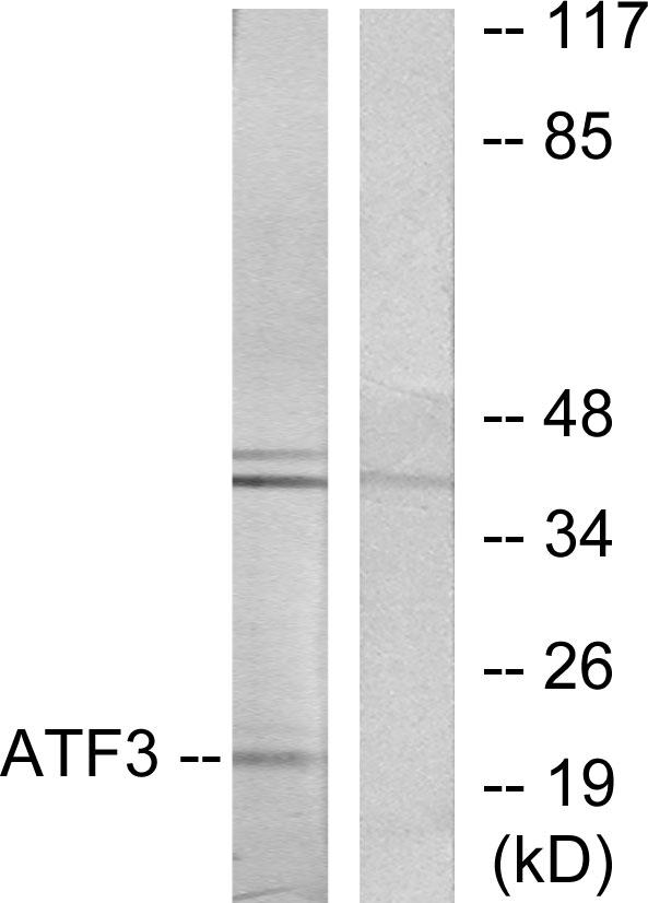 ATF3 Antibody - Western blot analysis of extracts from RAW264.7 cells, using ATF3 antibody.