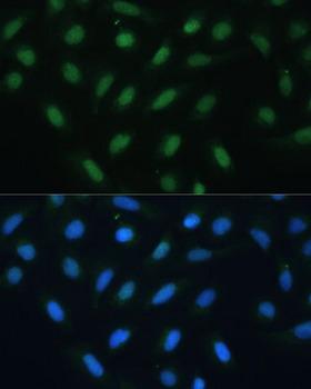 ATF3 Antibody - Immunofluorescence analysis of U-2OS cells using ATF3 Polyclonal Antibody at dilution of 1:100.Blue: DAPI for nuclear staining.