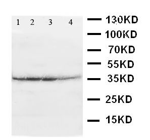 ATF4 Antibody - WB of ATF4 antibody. Lane 1: A431 Cell Lysate. Lane 2: RAJI Cell Lysate. Lane 3: CEM Cell Lysate. Lane 4: HUT Cell Lysate.