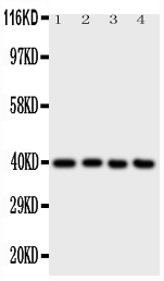 ATF4 Antibody - Anti-ATF4 antibody, Western blotting All lanes: Anti ATF4 at 0.5ug/ml Lane 1: A431 Whole Cell Lysate at 40ug Lane 2: RAJI Whole Cell Lysate at 40ug Lane 3: CEM Whole Cell Lysate at 40ug Lane 4: HUT Whole Cell Lysate at 40ug Predicted bind size: 39KD Observed bind size: 39KD