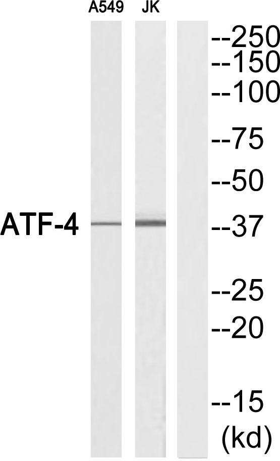 ATF4 Antibody - Western blot analysis of extracts from A549 cells and Jurkat cells, using ATF-4 (Ab-219) Antibody.