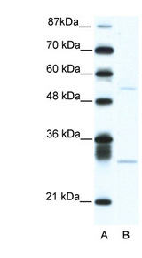 ATF4 Antibody - ATF4 antibody ARP38067_T100-NP_001666-ATF4 (activating transcription factor 4 (tax-responsive enhancer element B67)) Antibody Western blot of Jurkat lysate.  This image was taken for the unconjugated form of this product. Other forms have not been tested.