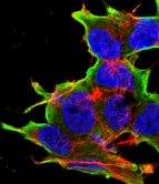 ATF4 Antibody - Detection of ATF4 in neuroblastoma cell line SK-N-BE with ATF4 Monoclonal Antibody at 10ug/ml: DAPI (blue) nuclear stain, Texas Red F actin stain, ATTO 488 (green) ATF4 stain.