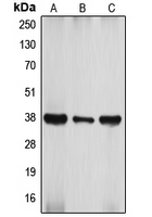 ATF4 Antibody - Western blot analysis of ATF4 expression in MCF7 (A); mouse brain (B); rat brain (C) whole cell lysates.